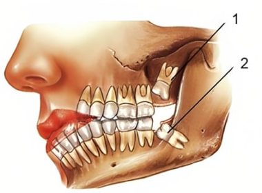 Oral Surgery